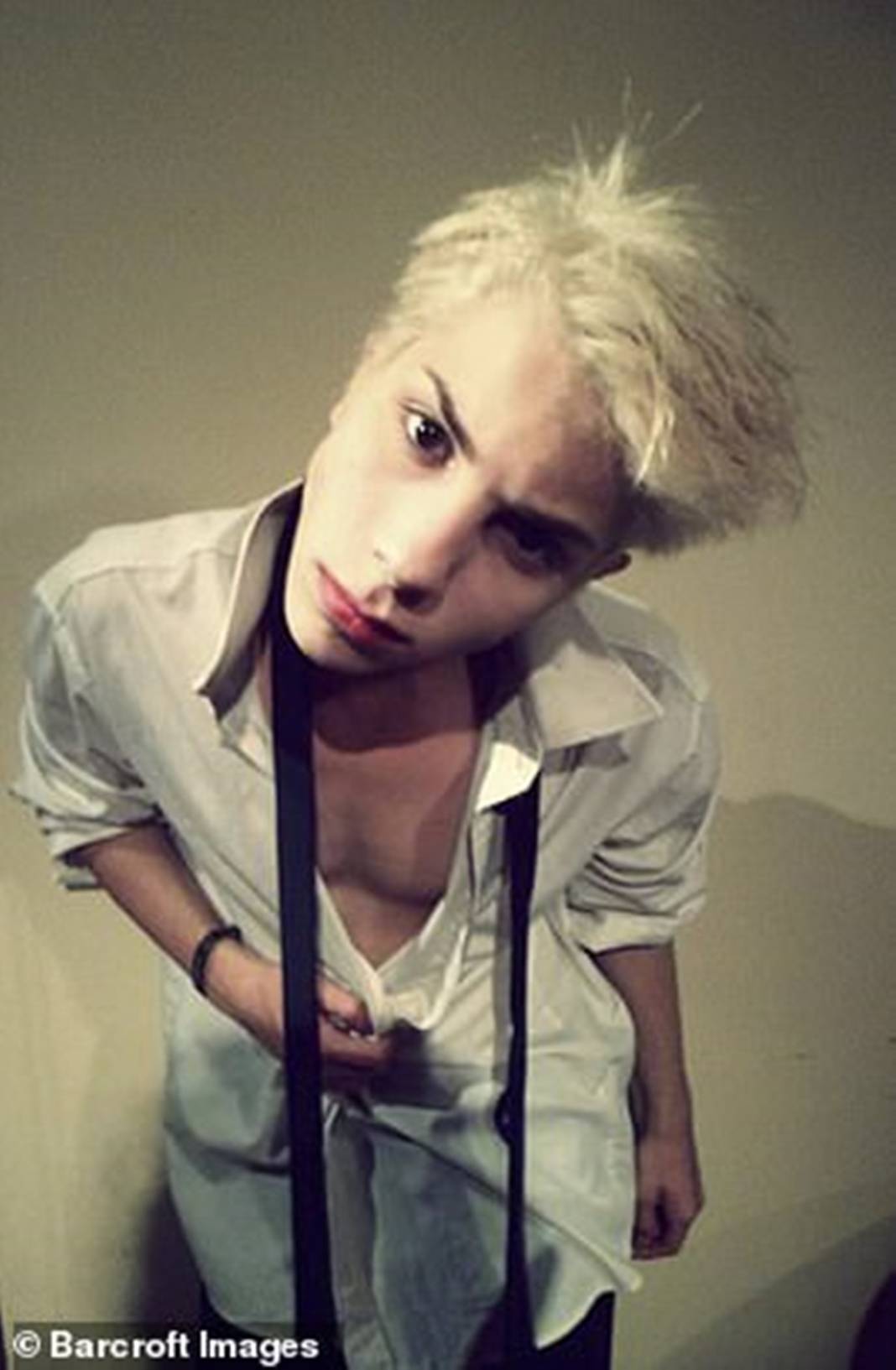 Michael Jackson'a benzemek için 40 bin dolar harcadı! Bakın neye benzedi... 3